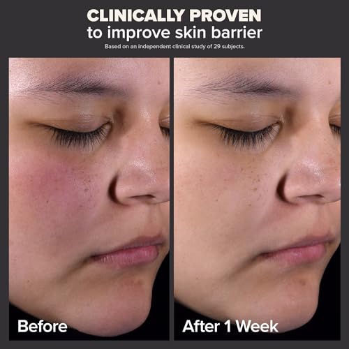 Paula’s Choice SKIN PERFECTING 2% BHA Liquid Salicylic Acid Exfoliant-Facial Exfoliant for Blackheads - Image 3